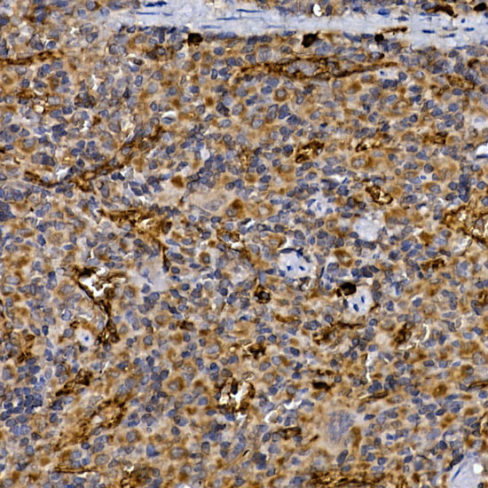 CD26 Antibody in Immunohistochemistry (Paraffin) (IHC (P))