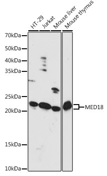 MED18 Antibody in Western Blot (WB)