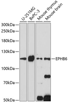 EphB6 Antibody in Western Blot (WB)