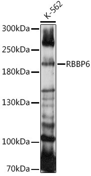 RBBP6 Antibody in Western Blot (WB)