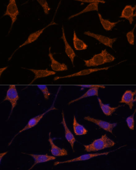 Ribulose-phosphate 3-epimerase Antibody in Immunocytochemistry (ICC/IF)