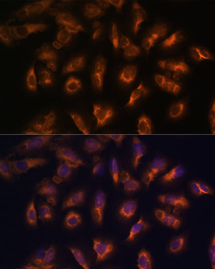 SSTR2 Antibody in Immunocytochemistry (ICC/IF)