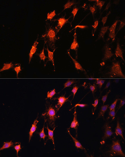 PRR5 Antibody in Immunocytochemistry (ICC/IF)