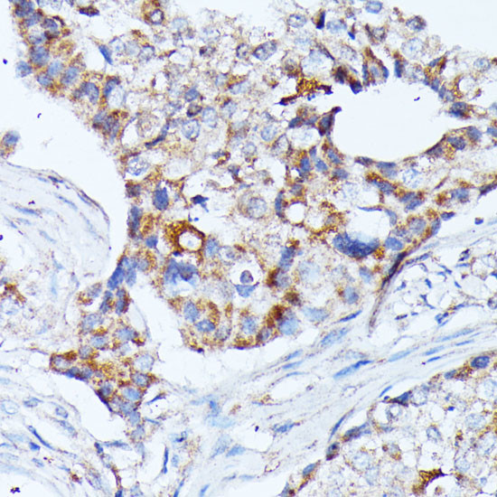 Kir4.2 (KCNJ15) Antibody in Immunohistochemistry (Paraffin) (IHC (P))