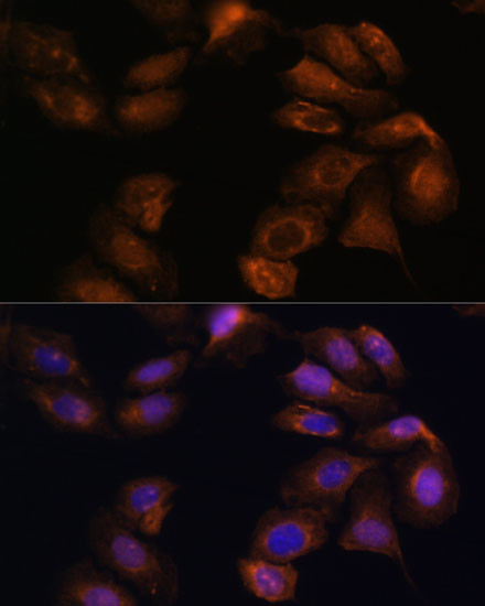 ROBO1 Antibody in Immunocytochemistry (ICC/IF)