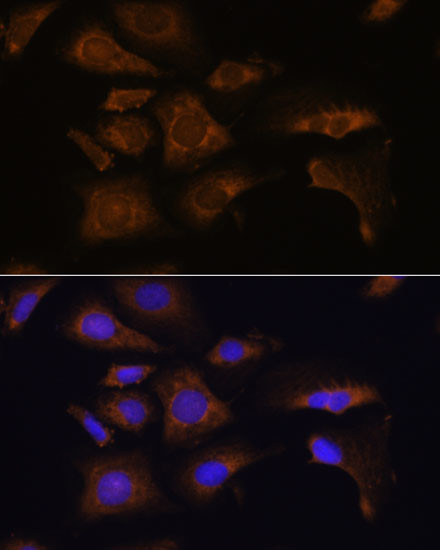 RPS25 Antibody in Immunocytochemistry (ICC/IF)