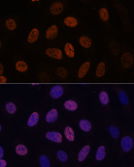 WDHD1 Antibody in Immunocytochemistry (ICC/IF)