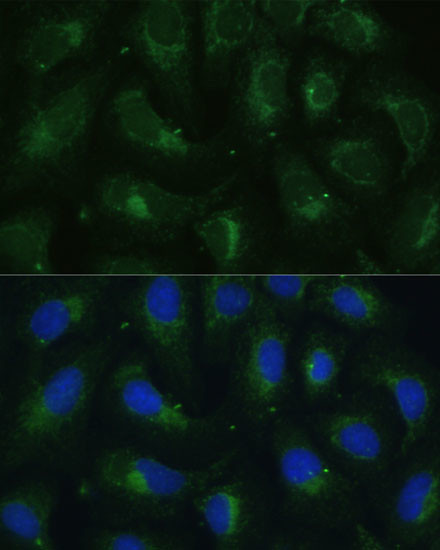 SULT1C4 Antibody in Immunocytochemistry (ICC/IF)