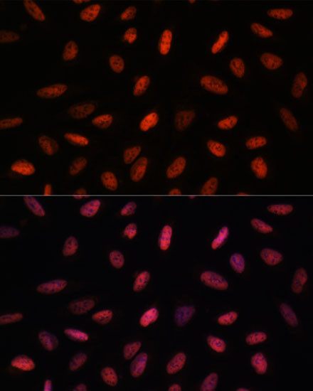 ARID1B Antibody in Immunocytochemistry (ICC/IF)