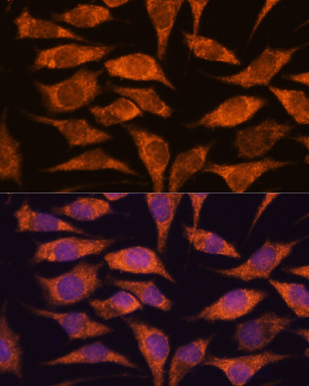 MRPS14 Antibody in Immunocytochemistry (ICC/IF)
