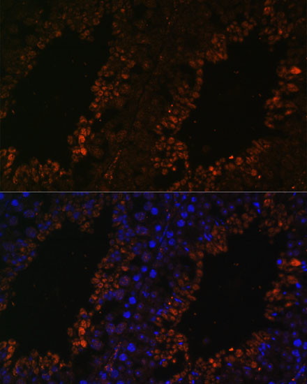 TPD52L3 Antibody in Immunohistochemistry (Paraffin) (IHC (P))