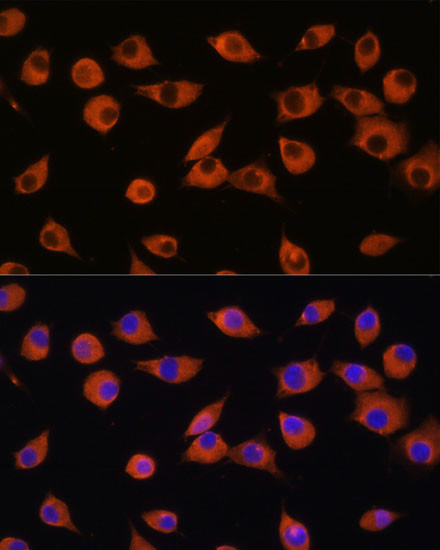 DNER Antibody in Immunocytochemistry (ICC/IF)