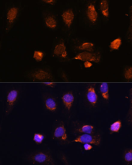RPL34 Antibody in Immunocytochemistry (ICC/IF)