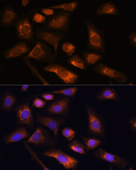 RPS13 Antibody in Immunocytochemistry (ICC/IF)