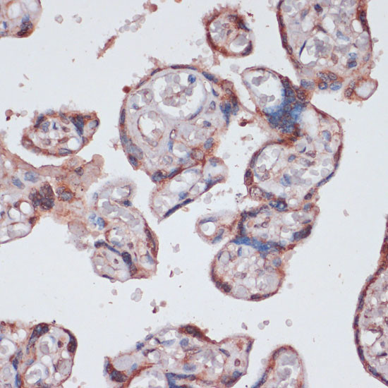Mission Rps13 RPS13 Polyclonal Antibody | Invitrogen (PA5-120388)