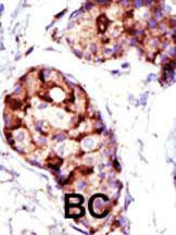 TSG101 Antibody in Immunohistochemistry (Paraffin) (IHC (P))