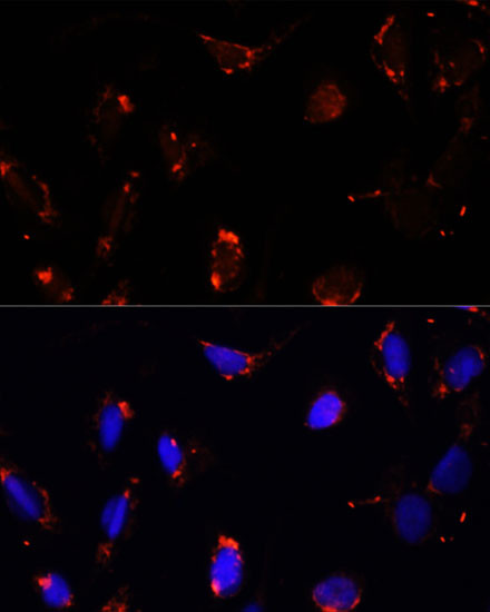 TBRG4 Antibody in Immunocytochemistry (ICC/IF)