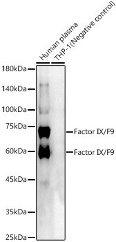 Factor IX Antibody in Western Blot (WB)