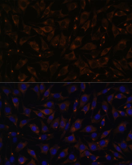 PLLP Antibody in Immunocytochemistry (ICC/IF)