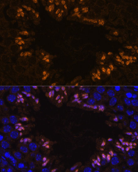 ELSPBP1 Antibody in Immunohistochemistry (Paraffin) (IHC (P))