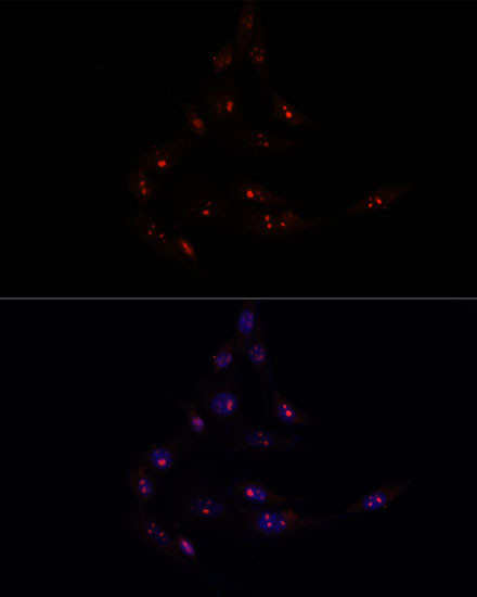 METT10D Antibody in Immunocytochemistry (ICC/IF)