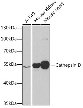 Cathepsin D Antibody in Western Blot (WB)