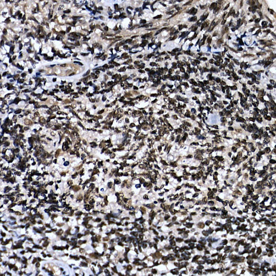 ZNF384 Antibody in Immunohistochemistry (Paraffin) (IHC (P))