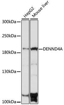 DENND4A Antibody in Western Blot (WB)