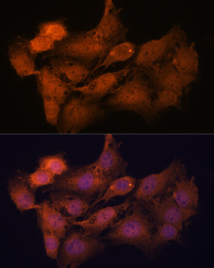SYCP2 Antibody in Immunocytochemistry (ICC/IF)