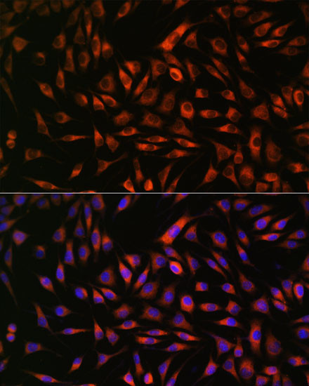 EML4 Antibody in Immunocytochemistry (ICC/IF)