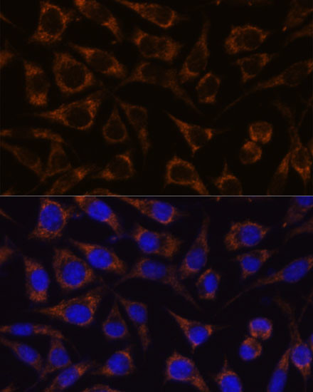 GTPBP8 Antibody in Immunocytochemistry (ICC/IF)