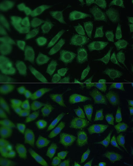 ARL3 Antibody in Immunocytochemistry (ICC/IF)