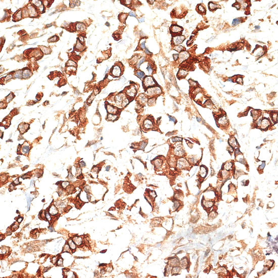 Cytokeratin 13 Antibody in Immunohistochemistry (Paraffin) (IHC (P))