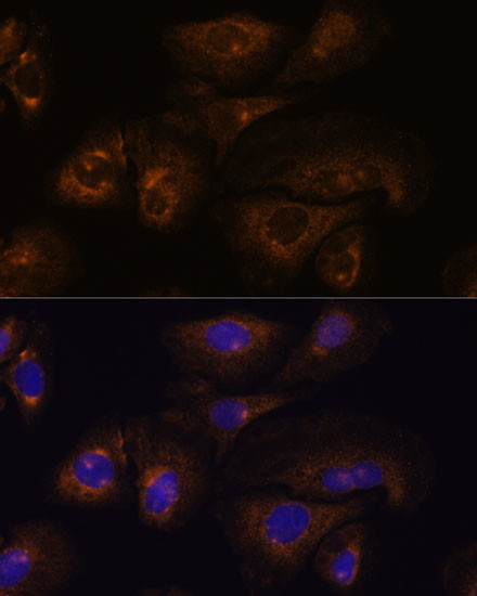 Prostasin Antibody in Immunocytochemistry (ICC/IF)
