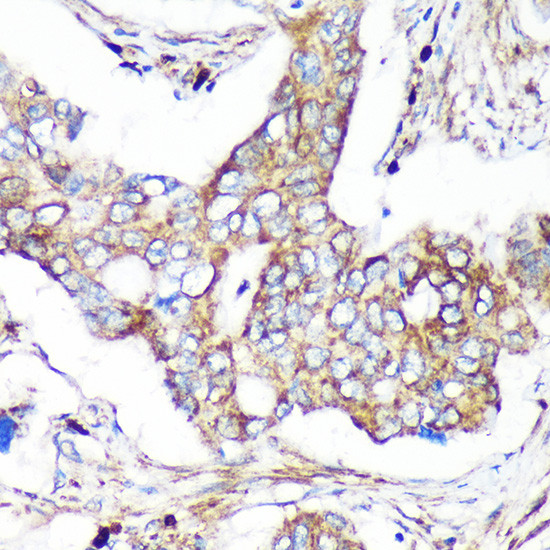 CAND2 Antibody in Immunohistochemistry (Paraffin) (IHC (P))