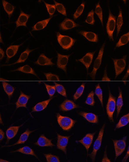 CTNNA3 Antibody in Immunocytochemistry (ICC/IF)