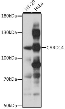 CARD14 Antibody in Western Blot (WB)