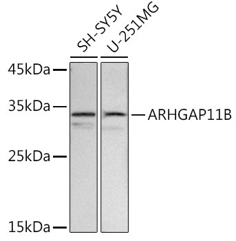 ARHGAP11B Antibody in Western Blot (WB)
