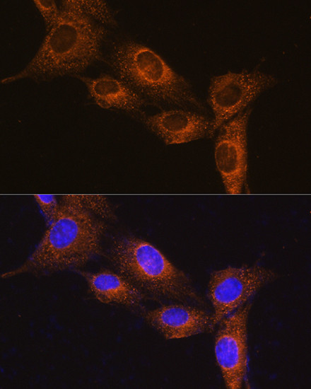 Neuropeptide B Antibody in Immunocytochemistry (ICC/IF)