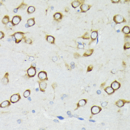 PDPK1 Antibody in Immunohistochemistry (Paraffin) (IHC (P))