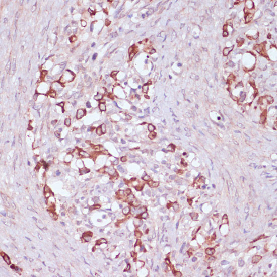 UGT2B15 Antibody in Immunohistochemistry (Paraffin) (IHC (P))