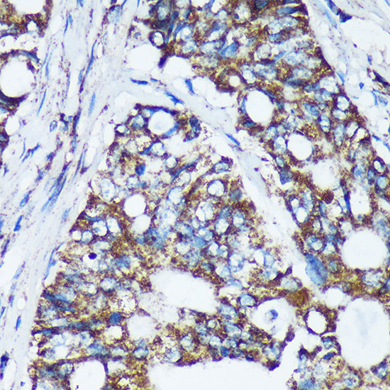 NKIAMRE Antibody in Immunohistochemistry (Paraffin) (IHC (P))