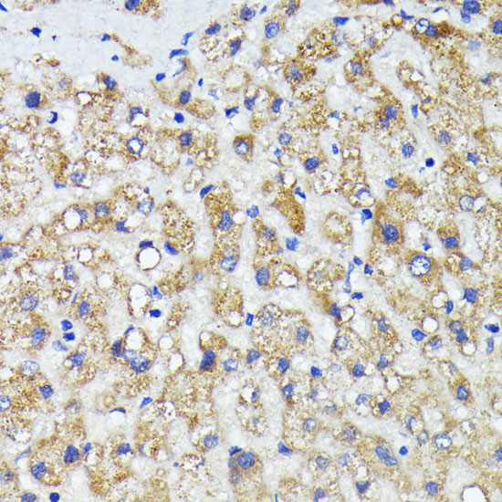 AMOTL2 Antibody in Immunohistochemistry (Paraffin) (IHC (P))