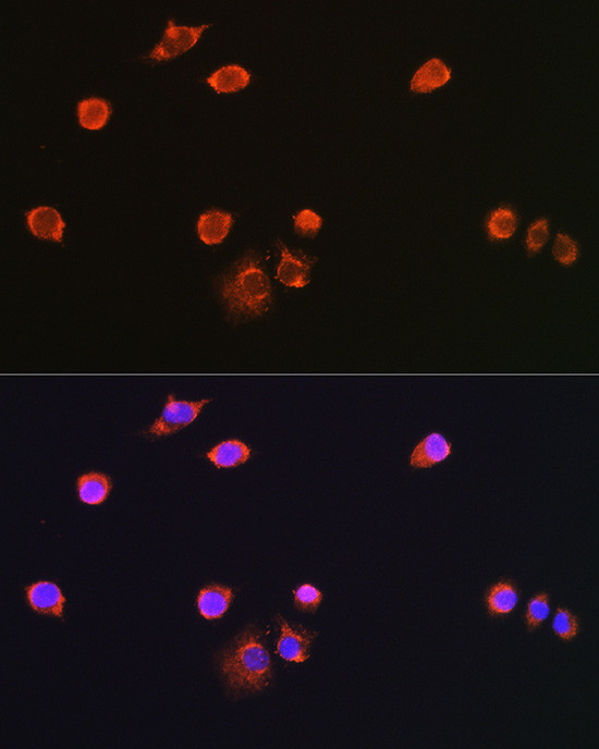 NPR3 Antibody in Immunocytochemistry (ICC/IF)
