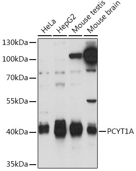 PCYT1A Antibody in Western Blot (WB)