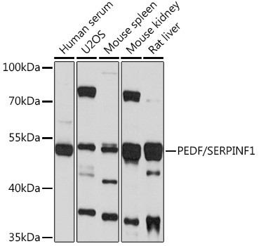 PEDF Antibody in Western Blot (WB)
