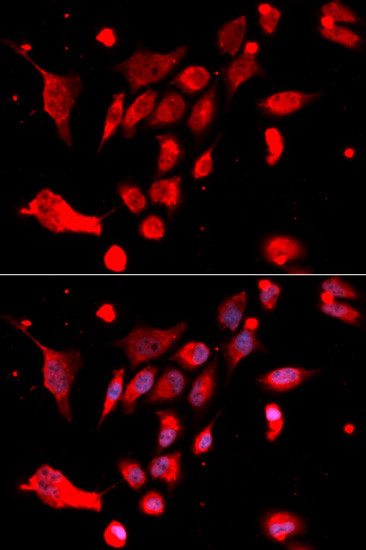 MAD2 Antibody in Immunocytochemistry (ICC/IF)