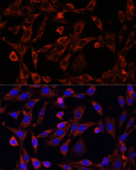 UCP3 Antibody in Immunocytochemistry (ICC/IF)