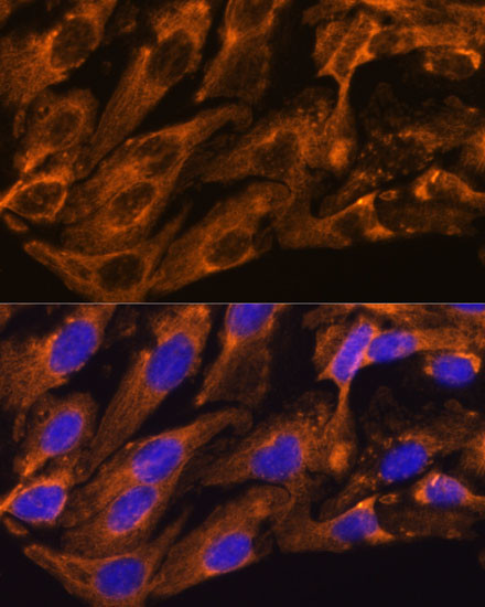 BRPF1 Antibody in Immunocytochemistry (ICC/IF)