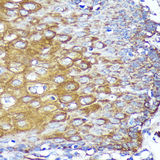 CYB5R1 Antibody in Immunohistochemistry (Paraffin) (IHC (P))